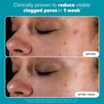 Paula's Choice SKIN PERFECTING 2% BHA Liquid Exfoliant with Salicylic Acid, Facial Polish for Enlarged Pores, Wrinkles & Fine Lines, Suitable for Blackhead-Prone Skin, Fragrance-Free - Image 6