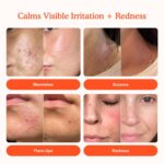 Tower 28 SOS Daily Rescue Facial Spray for Sensitive Skin, Hypochlorous Acid Spray Helps Visibly Reduce the Appearance of Redness and Breakouts, Travel Size Toner for Face, 1 FL Oz - Image 3