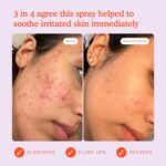 Tower 28 SOS Daily Rescue Facial Spray for Sensitive Skin, Hypochlorous Acid Spray Helps Visibly Reduce the Appearance of Redness and Breakouts, Travel Size Toner for Face, 1 FL Oz - Image 5