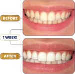 Lumineux Teeth Whitening Strips Kit - 9 Treatments (1 Month) - Peroxide Free - Enamel Safe for Whiter Teeth - Whitening Without The Sensitivity - Dentist Formulated - Sensitivity Free - Image 4